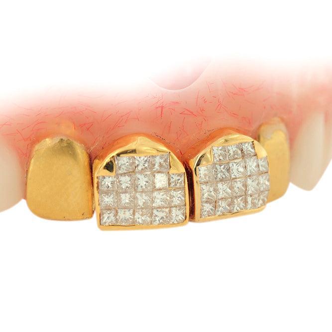JDTK-DTG1 - FOUR INDIVIDUAL TEETH DENTURE GRILL - Johnny Dang & Co