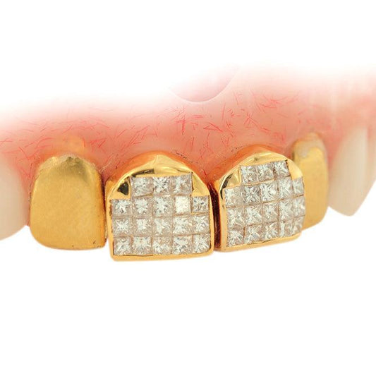 JDTK-DTG1 - FOUR INDIVIDUAL TEETH DENTURE GRILL - Johnny Dang & Co
