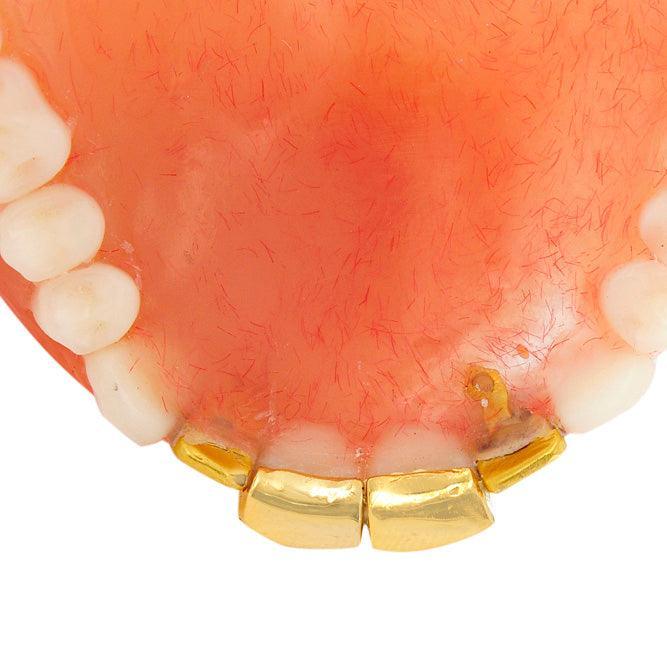 JDTK-DTG1 - FOUR INDIVIDUAL TEETH DENTURE GRILL - Johnny Dang & Co