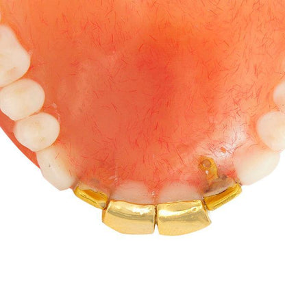 JDTK-DTG1 - FOUR INDIVIDUAL TEETH DENTURE GRILL - Johnny Dang & Co