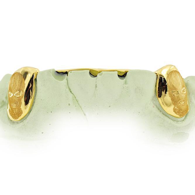 ENGRAVED TEETH WITH BACK BAR - Johnny Dang & Co