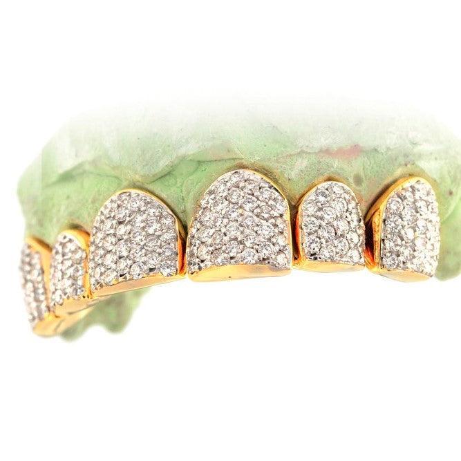 TVJ161011 SPECIAL HAND PRONG SET INDIVIDUALS - Johnny Dang & Co