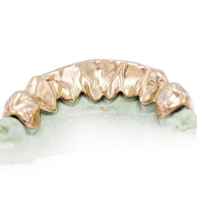 Solid Bottom Grillz 10K - Johnny Dang & Co