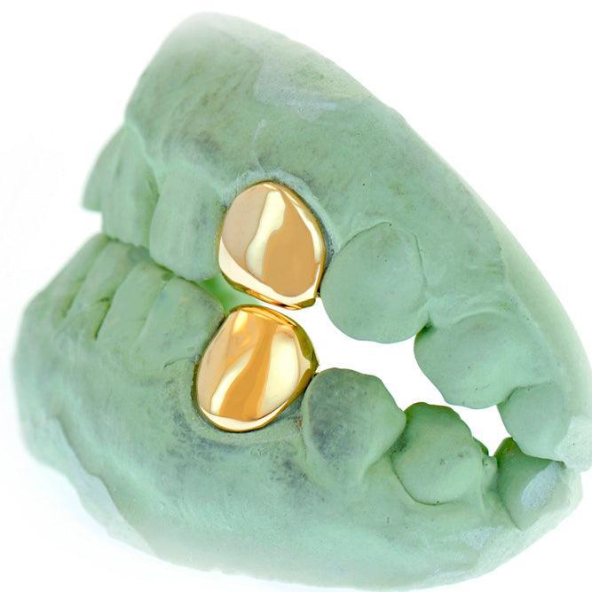 JDTK-S151506-1 SINGLE 18K INDIVIDUAL PERMANENT Cap / Tooth - Johnny Dang & Co