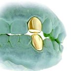 JDTK-S151506-1 SINGLE 18K INDIVIDUAL PERMANENT Cap / Tooth - Johnny Dang & Co