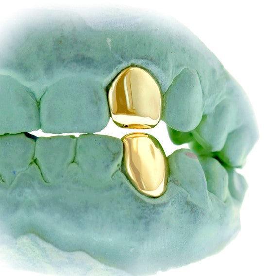 JDTK-S151506-1 SINGLE 18K INDIVIDUAL PERMANENT Cap / Tooth - Johnny Dang & Co