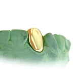 JDTK-S151506-1 SINGLE 18K INDIVIDUAL PERMANENT Cap / Tooth - Johnny Dang & Co