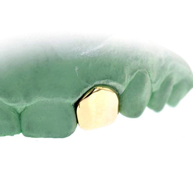 JDTK-S151506-1 SINGLE 18K INDIVIDUAL PERMANENT Cap / Tooth - Johnny Dang & Co