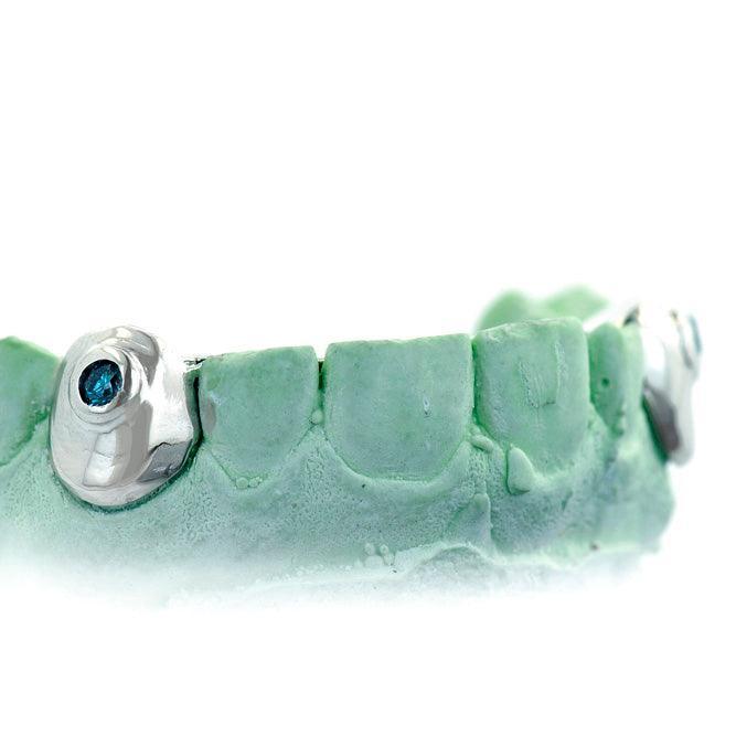 JDTK-S151607-1 SINGLE 18K INDIVIDUAL TOOTH WITH A SINGLE BLUE DIAMOND - Johnny Dang & Co