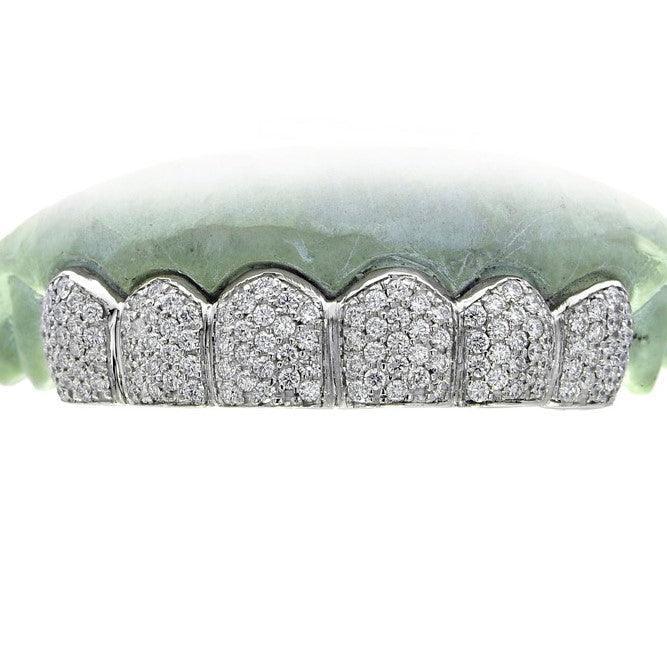 JDTK-S150809-1 6 PIECE HAND PRONG SET DIAMOND GRILL AKA HONEYCOMB SETTING - Johnny Dang & Co