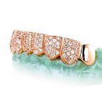 8 TEETH 6 WITH DIAMONDSHONEYCOMB PRONG SETTING - Johnny Dang & Co