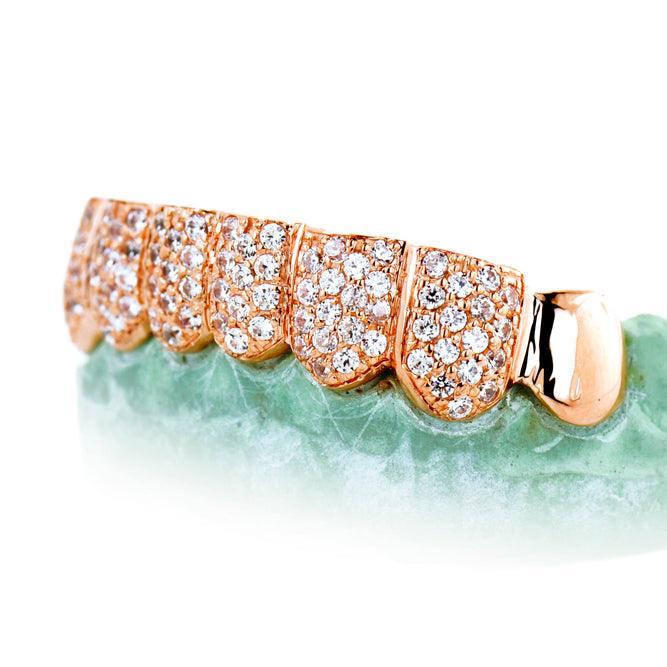 8 TEETH 6 WITH DIAMONDSHONEYCOMB PRONG SETTING - Johnny Dang & Co