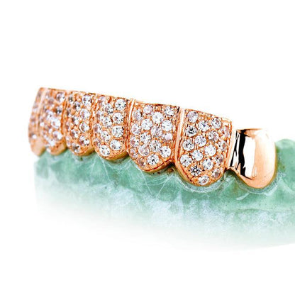 8 TEETH 6 WITH DIAMONDSHONEYCOMB PRONG SETTING - Johnny Dang & Co