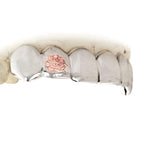 JDTK-ENG15252-2 Engraved Teeth - Johnny Dang & Co