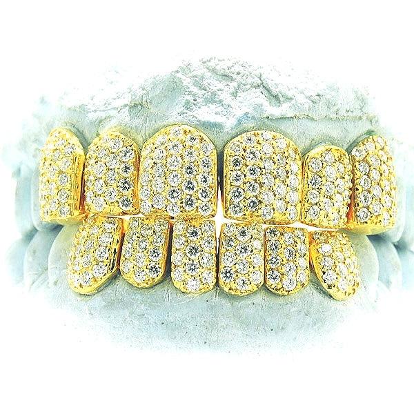 JDTK-S151806-2-NEW -18K Individual Diamond Prong Set Permanent Teeth - Johnny Dang & Co