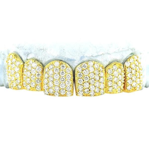 JDTK-S151806-2-NEW -18K Individual Diamond Prong Set Permanent Teeth - Johnny Dang & Co