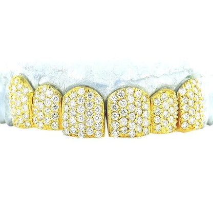 JDTK-S151806-2-NEW -18K Individual Diamond Prong Set Permanent Teeth - Johnny Dang & Co