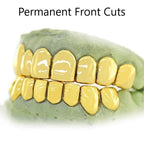 Gold Teeth JDTK-3005A-6- Top 6 and Bottom 6 Grillz - Johnny Dang & Co