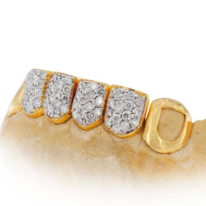 JDTK-S151607-4A- Prong Set Open Face Grillz - Johnny Dang & Co