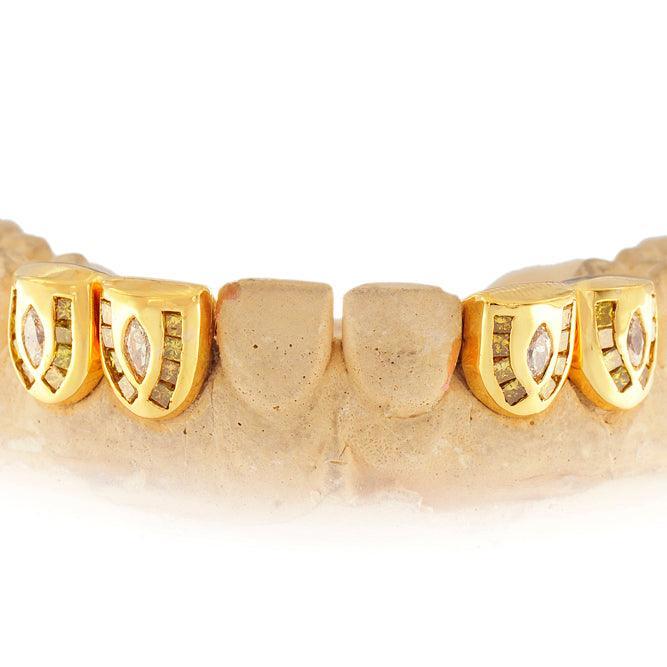 JDTK-S160103-1 18K INDIVIDUAL CHANNEL SET DIAMOND GRILL - Johnny Dang & Co