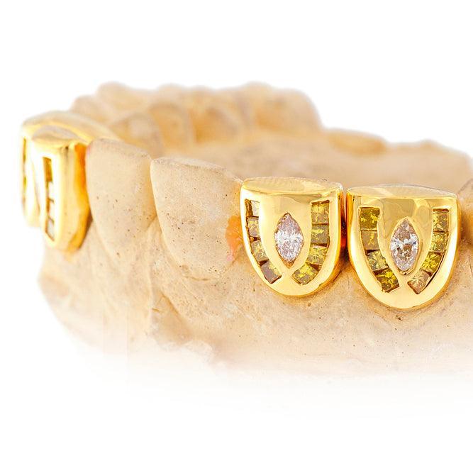 JDTK-S160103-1 18K INDIVIDUAL CHANNEL SET DIAMOND GRILL - Johnny Dang & Co