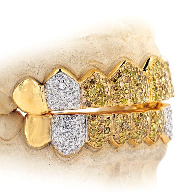 16 TEETH PRONG SET DIAMOND GRILL - S160206-1 - Johnny Dang & Co