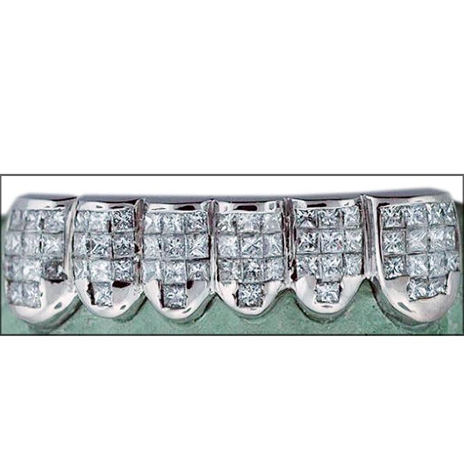 Invisible Set Grillz Johnny Dang & Co