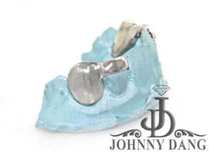 JDTK-S2530023 Gold teeth - Johnny Dang & Co