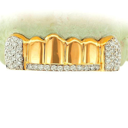 JDTK-S2530076-2 Custom 6 Piece Diamond Grill - Johnny Dang & Co