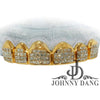 GOLDTEETH S-5060A 6 TEETH INVISIBLE HAND SET DIAMOND GRILL - Johnny Dang & Co