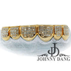 GOLDTEETH S-5060A 6 TEETH INVISIBLE HAND SET DIAMOND GRILL - Johnny Dang & Co