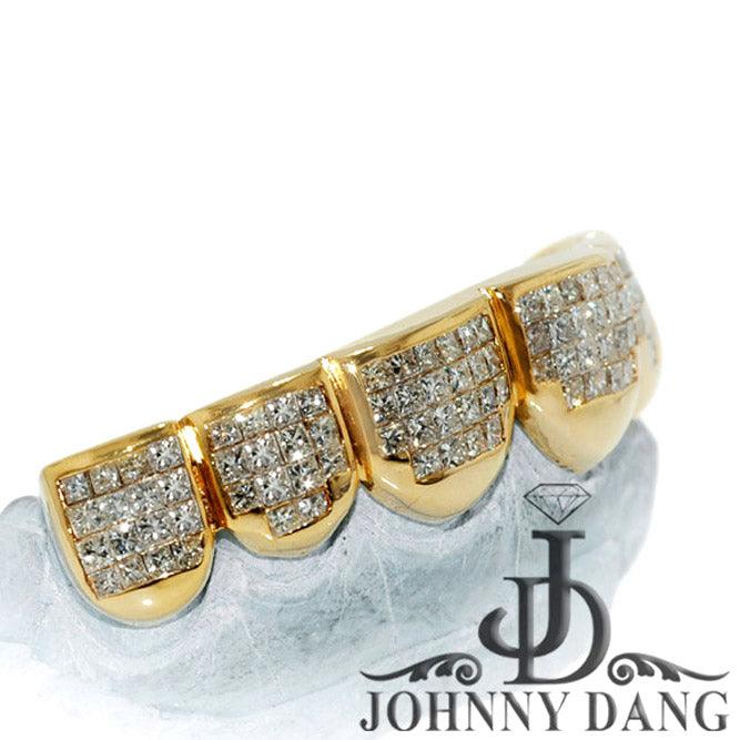 GOLDTEETH S-5060A 6 TEETH INVISIBLE HAND SET DIAMOND GRILL - Johnny Dang & Co