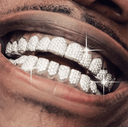 Custom Grillz Order - Deposit - Johnny Dang & Co