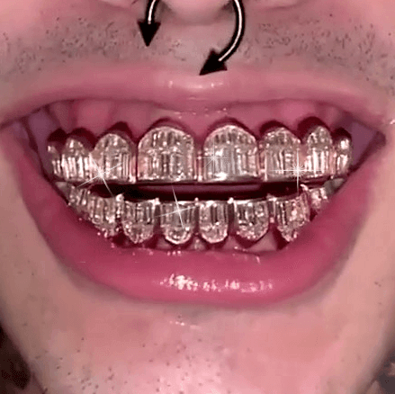 Custom Grillz Order Deposit – Johnny Dang Co