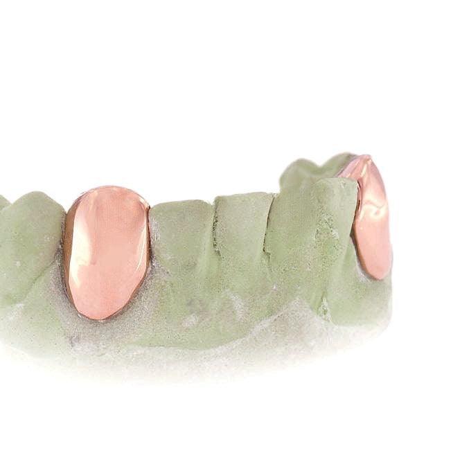 JDTK-3033F - 2 SolidTeeth with Back bar - Johnny Dang & Co