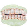 NEW Deluxe Carre Cut Invisible Grillz 10 Teeth VVS Diamonds - Johnny Dang & Co