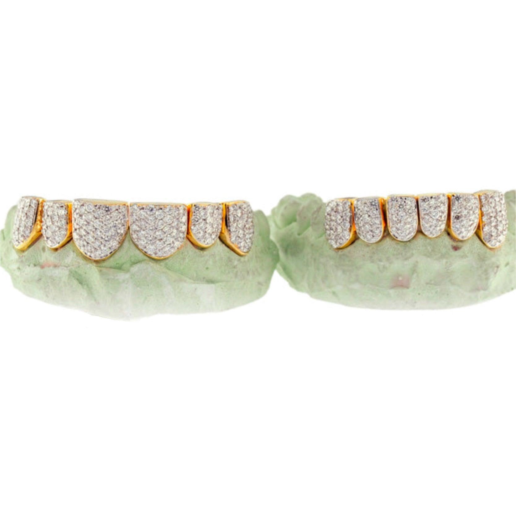 TVJ161011 SPECIAL HAND PRONG SET INDIVIDUALS - Johnny Dang & Co