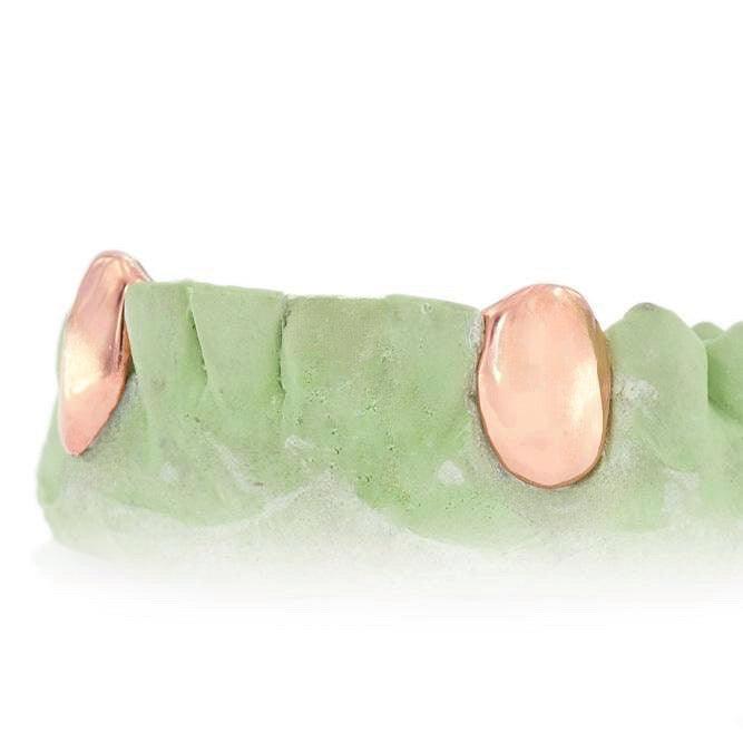 JDTK-3033F - 2 SolidTeeth with Back bar - Johnny Dang & Co