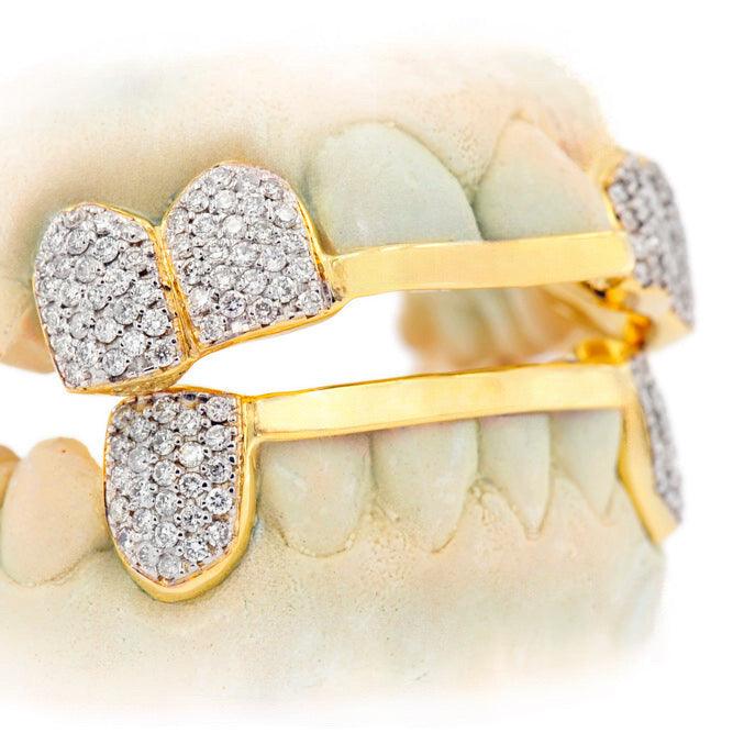 C-110 CUSTOM HAND PRONG SET DIAMOND GRILL - Johnny Dang & Co