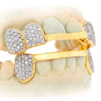 C-110 CUSTOM HAND PRONG SET DIAMOND GRILL - Johnny Dang & Co