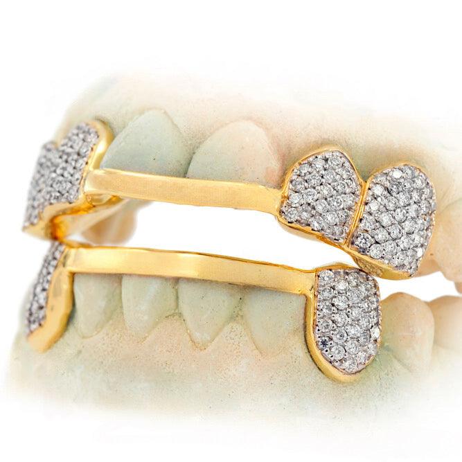 C-110 CUSTOM HAND PRONG SET DIAMOND GRILL - Johnny Dang & Co