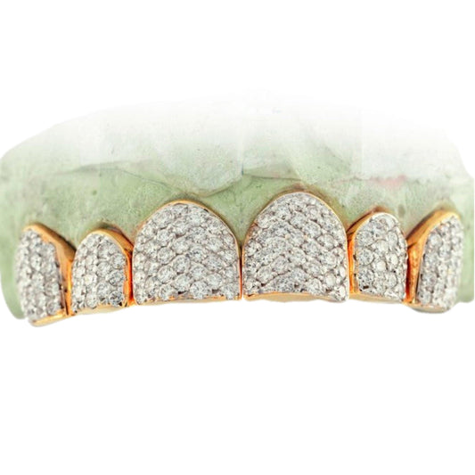 TVJ161011 SPECIAL HAND PRONG SET INDIVIDUALS - Johnny Dang & Co