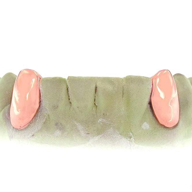 JDTK-3033F - 2 SolidTeeth with Back bar - Johnny Dang & Co