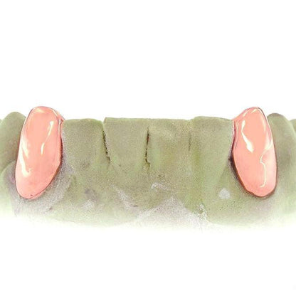 JDTK-3033F - 2 SolidTeeth with Back bar - Johnny Dang & Co