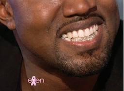 JDTK-S105-KANYE WEST'S CHOICE GRILLZ - Johnny Dang & Co