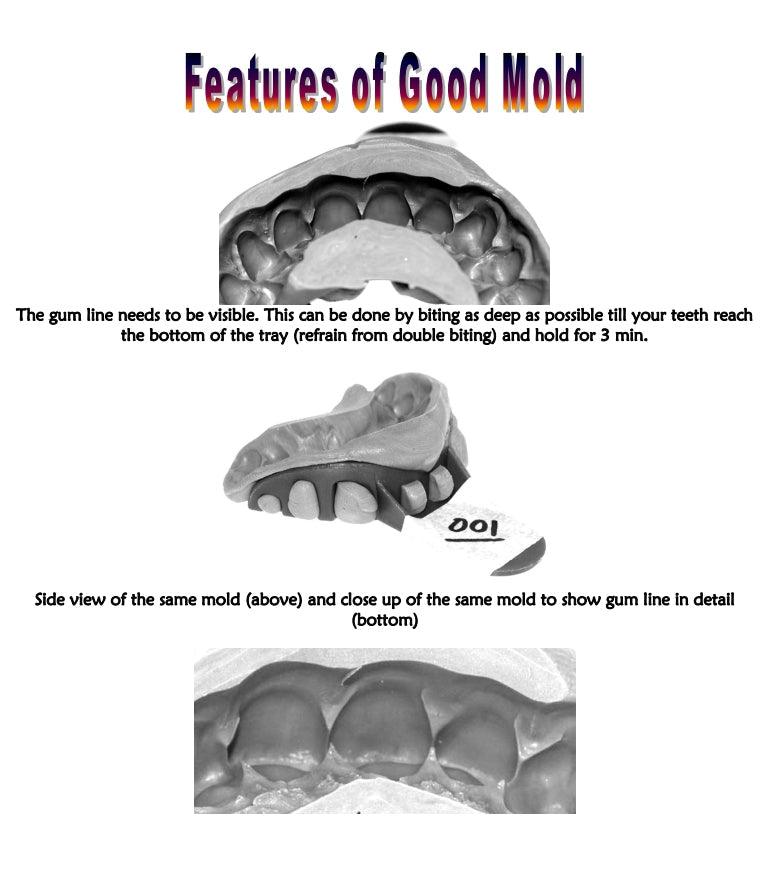 Custom Grillz Mold Kit For Teeth Impression Mouth Guard Mold Putty For  Grills