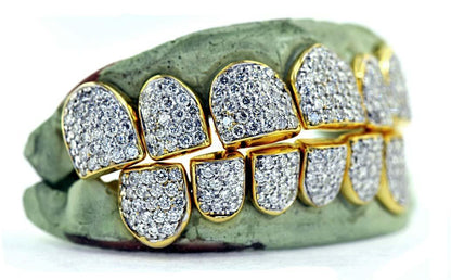 JDTK-G16-CHANDELIER - SI/VS/VVS Diamond Special Hand Prong Set Permanent Diamond Cap - Johnny Dang & Co