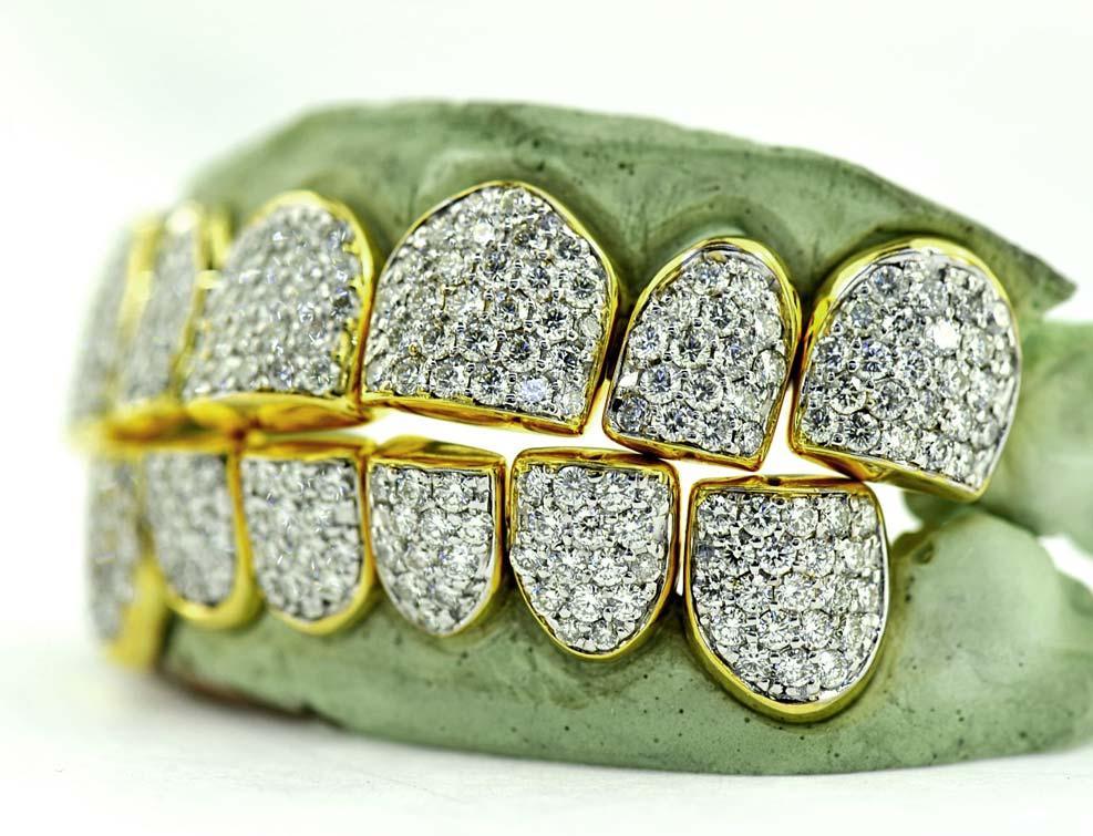 JDTK-G16-CHANDELIER - SI/VS/VVS Diamond Special Hand Prong Set Permanent Diamond Cap - Johnny Dang & Co