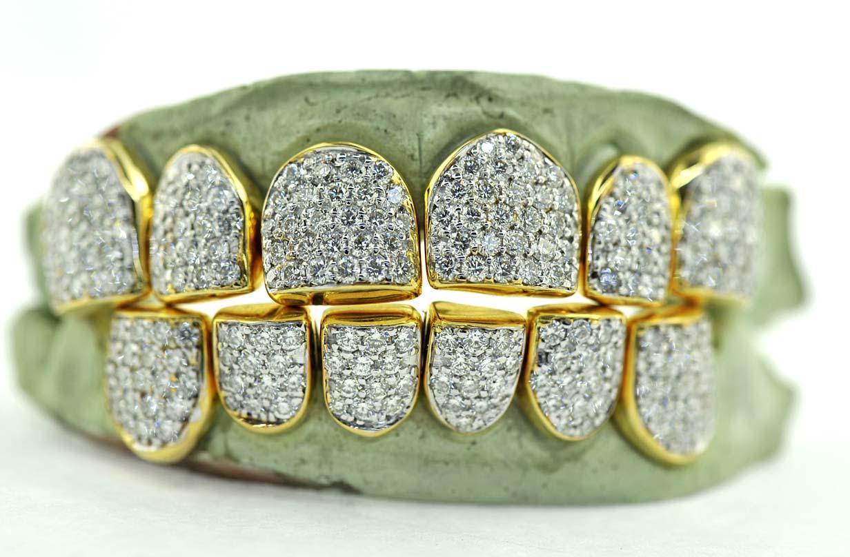 JDTK-G16-CHANDELIER - SI/VS/VVS Diamond Special Hand Prong Set Permanent Diamond Cap - Johnny Dang & Co