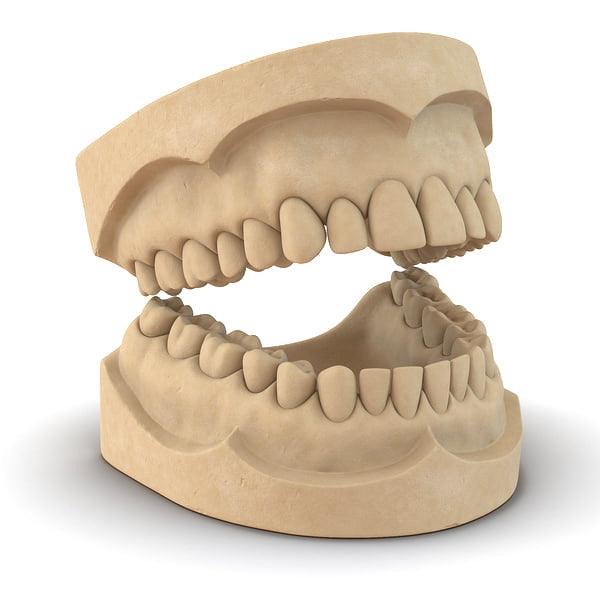 Easy DIY Dental Molding kit and Instructions-Single Kit - Johnny Dang & Co